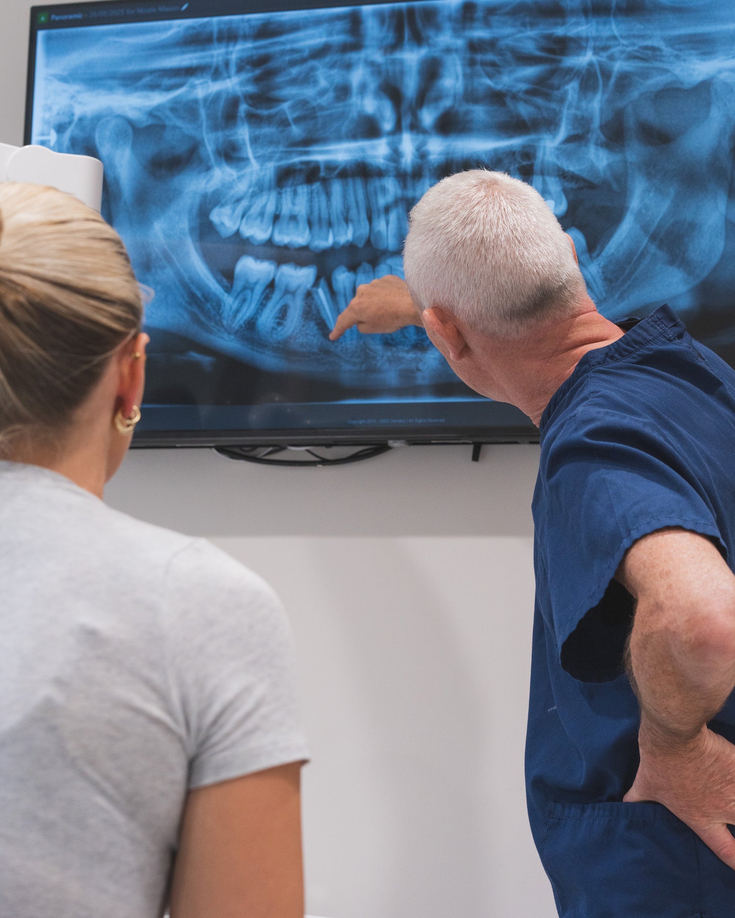 Are Dental Implants Painful? What to Expect