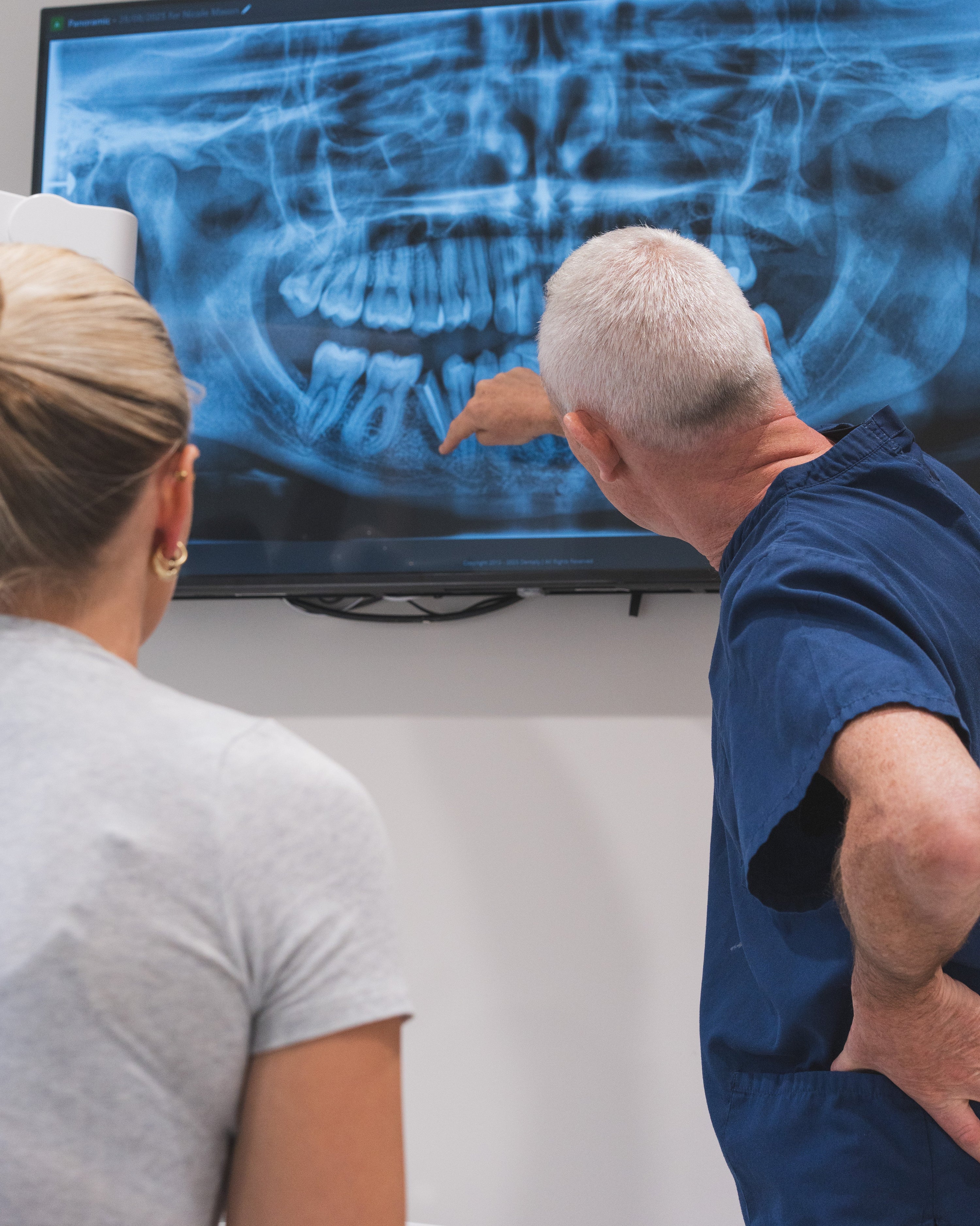 Are Dental Implants Painful? What to Expect