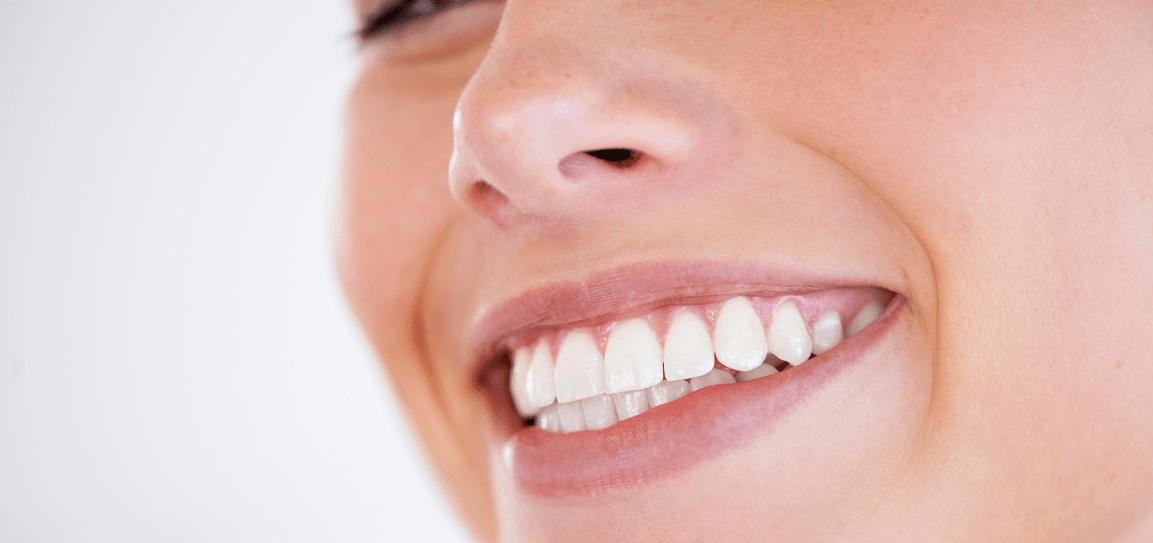 How Long Does Invisalign Take? A Realistic Timeline