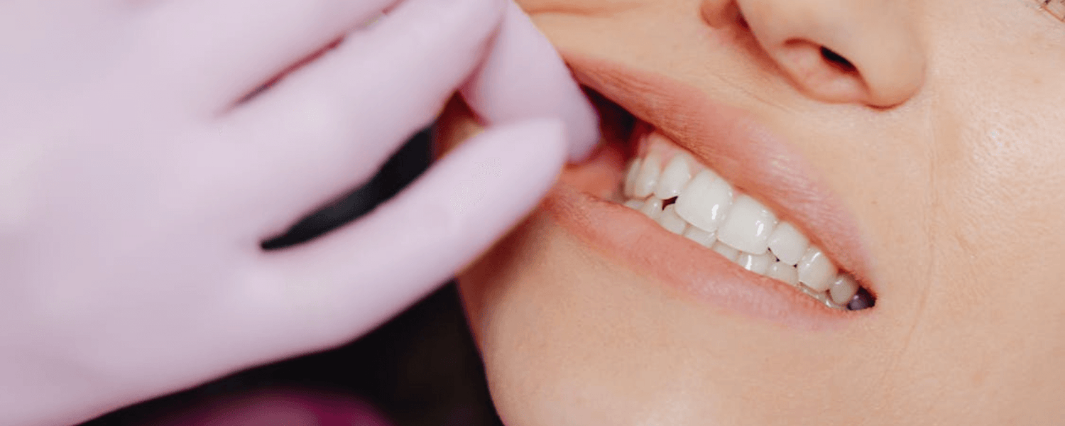 Essential Precautions to Consider Before Getting Dental Implants