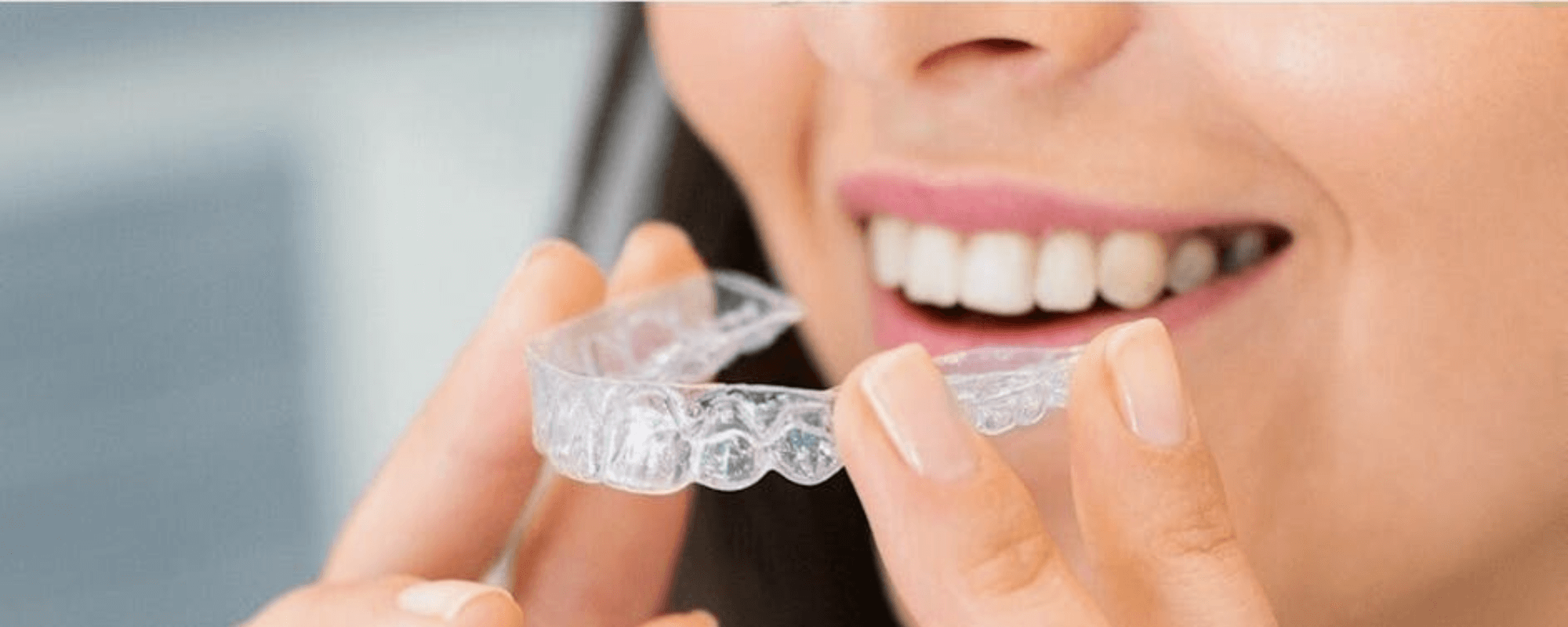 Invisalign Costs: What You Should Know