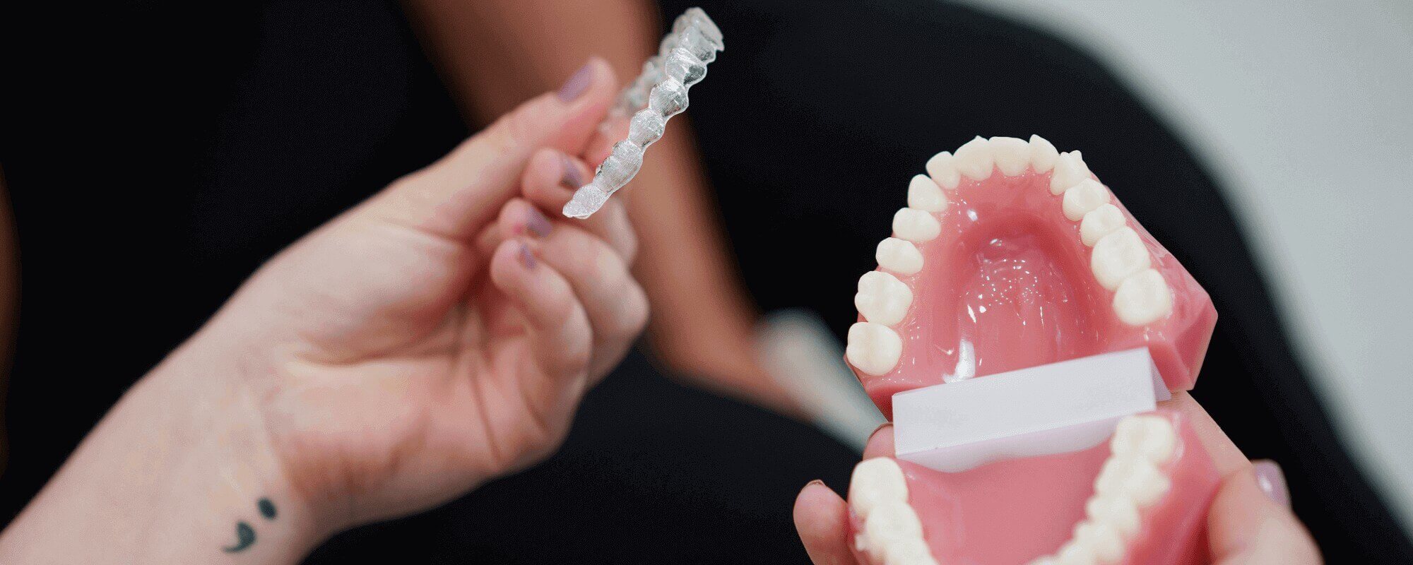 Are Invisalign Braces Worth The Price?