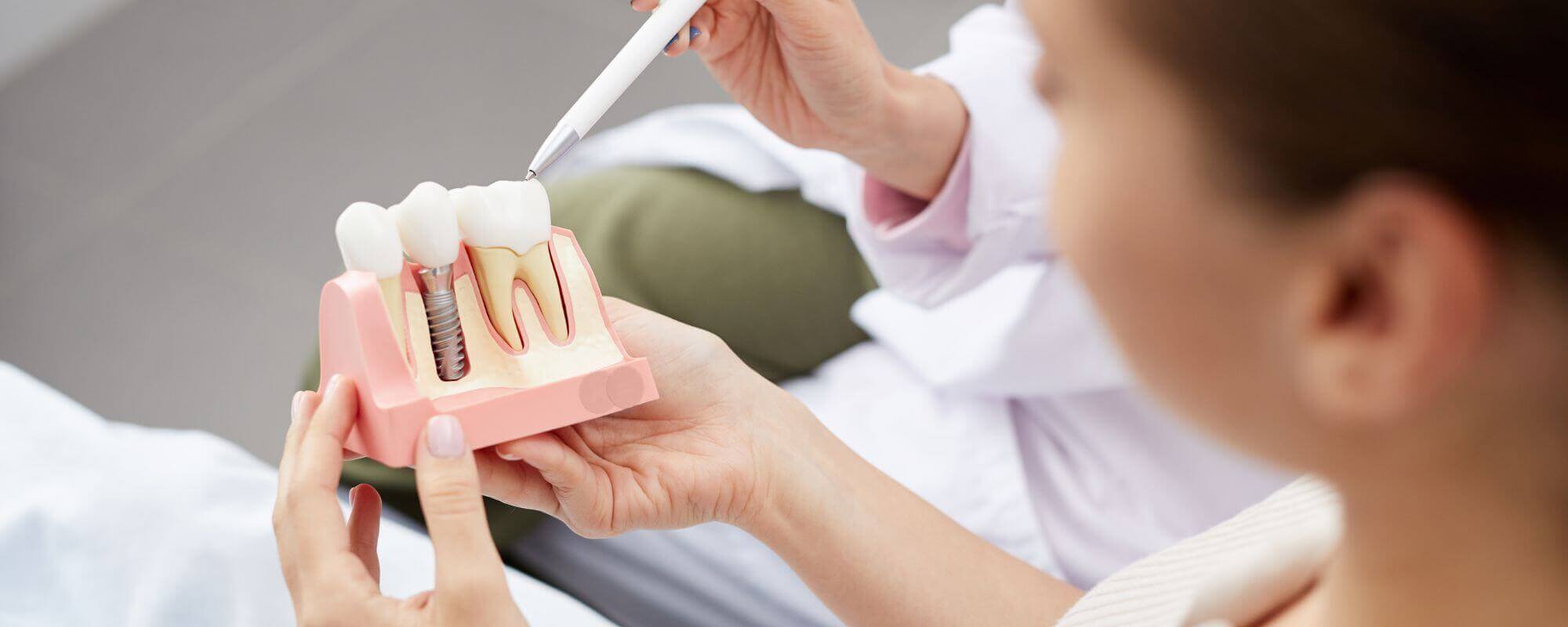 How Much Do Dental Implants Cost?