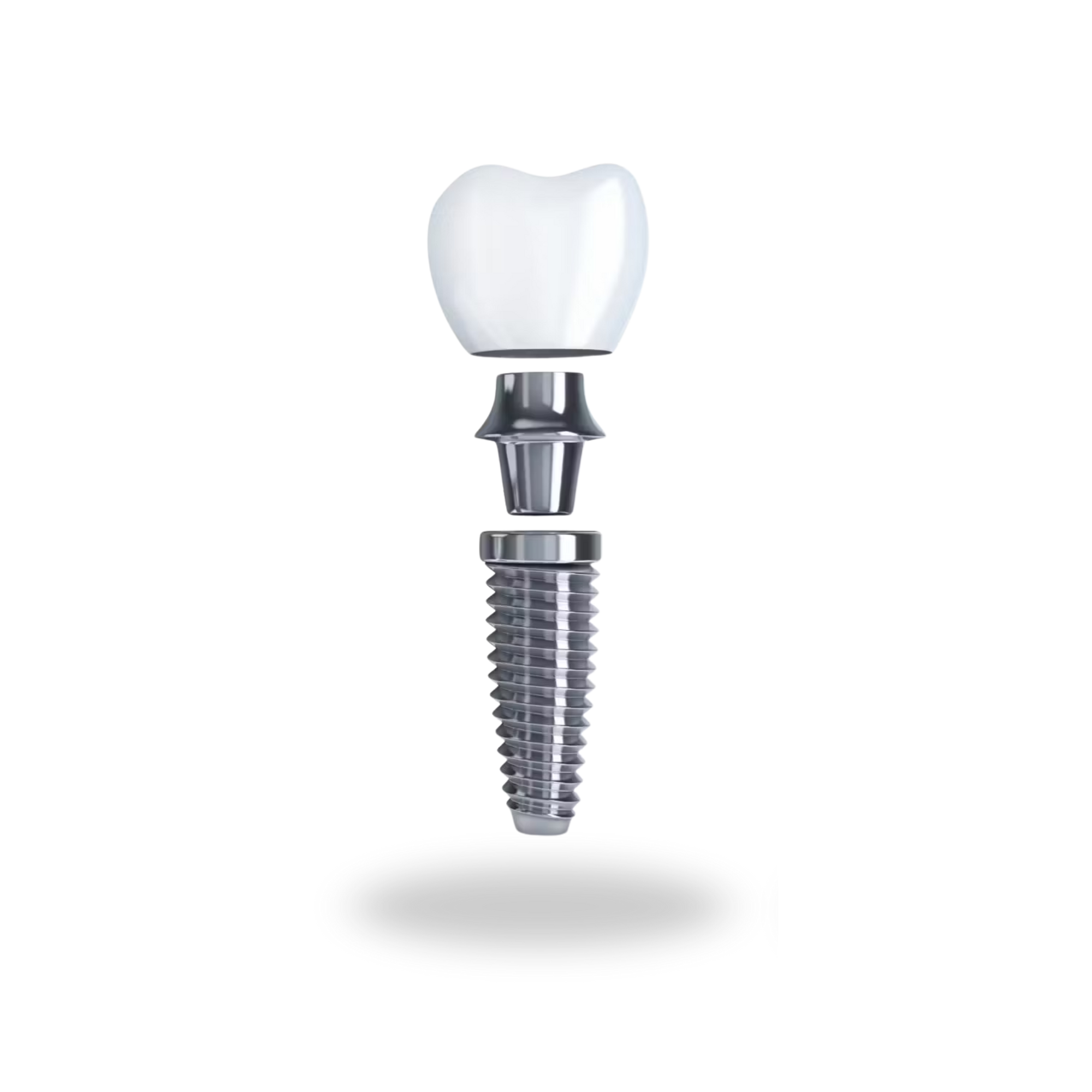 Single Dental Implants at Stella Dental