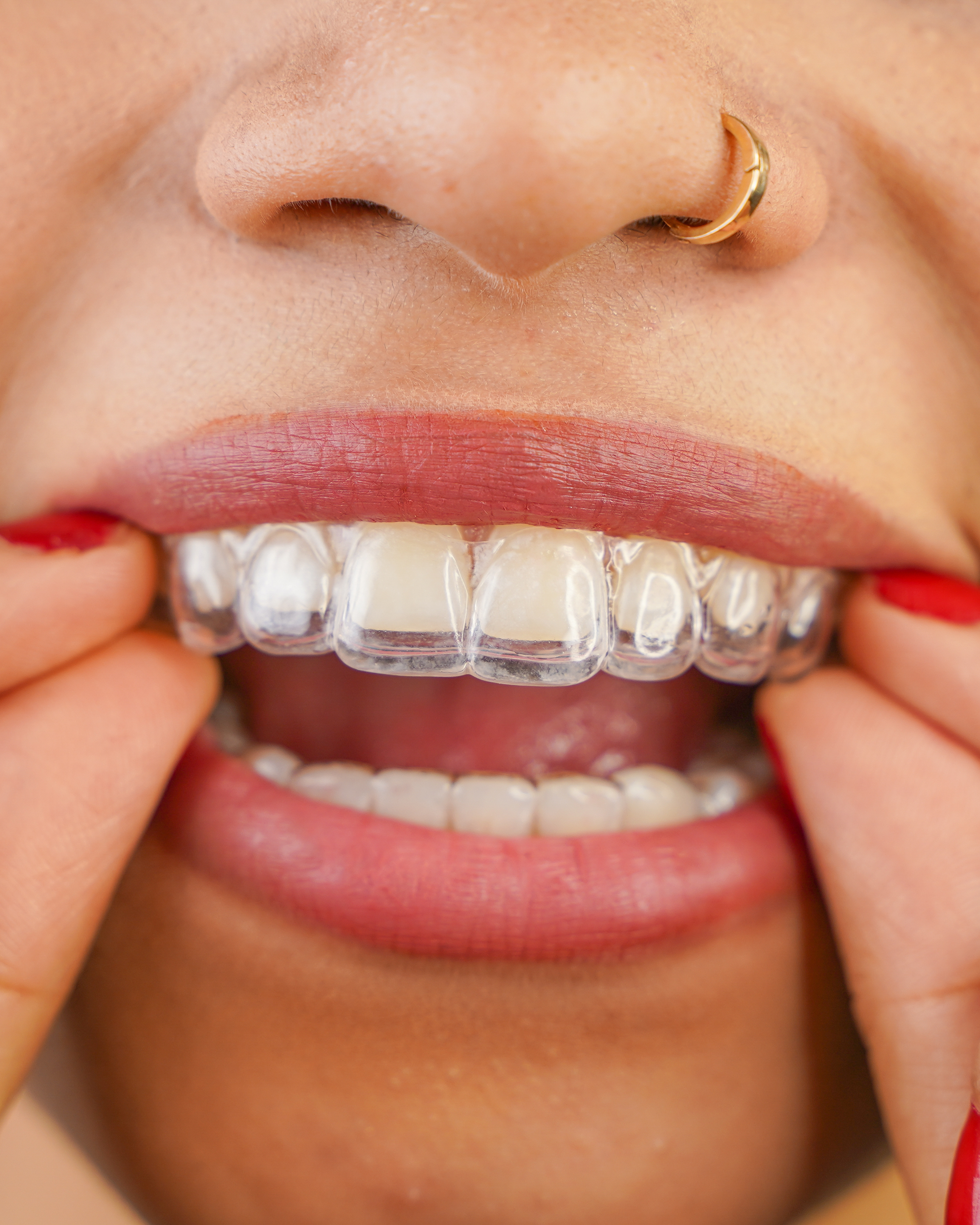 Stella Dental Client trying her invisalign