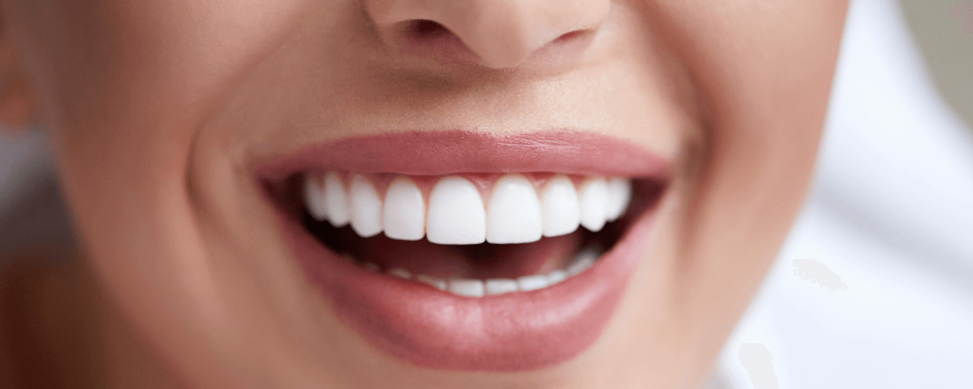 Woman smiling with dental implants and white teeth